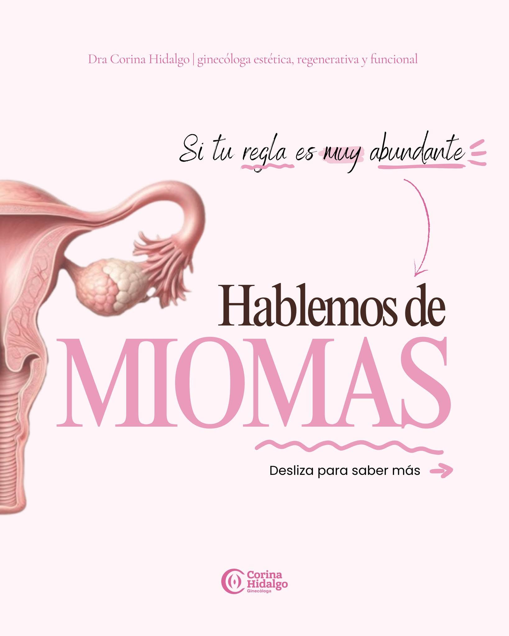 Publicación educativa sobre miomas de Corina Hidalgo Mori